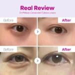 کرم دور چشم کلسیم‌دار دکتر ملاکسین Dr.Melaxin | مدل Dark Spot | سفت‌کننده پوست و رفع تیرگی دور چشم | ۱۵ گرم - Image 2